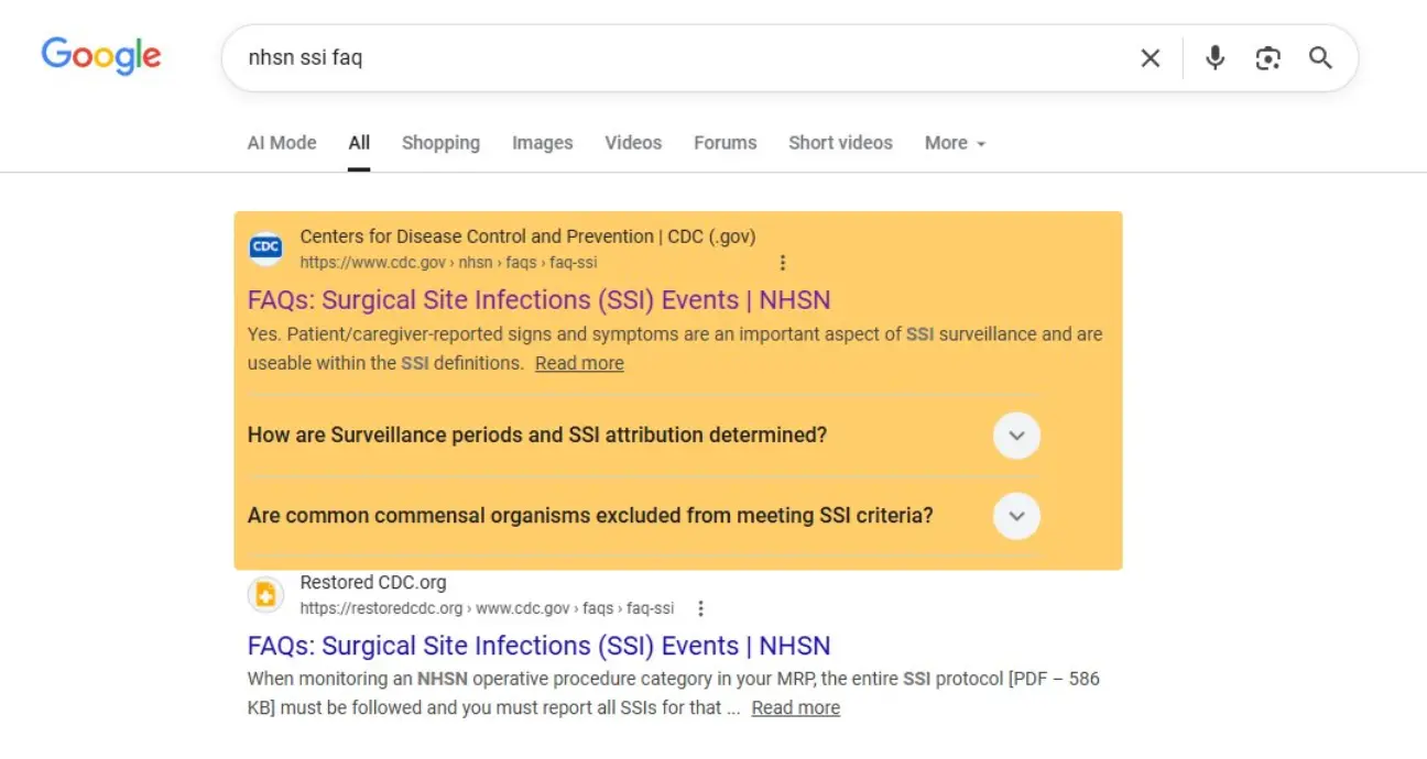 Before: FAQ rich results visible in Google Search